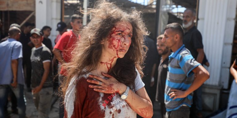 Journalist Bayan Abusultan walks away, injured, from Israel's attack on the Al-Baqa Cafe in Gaza City, on June 30, 2025.
